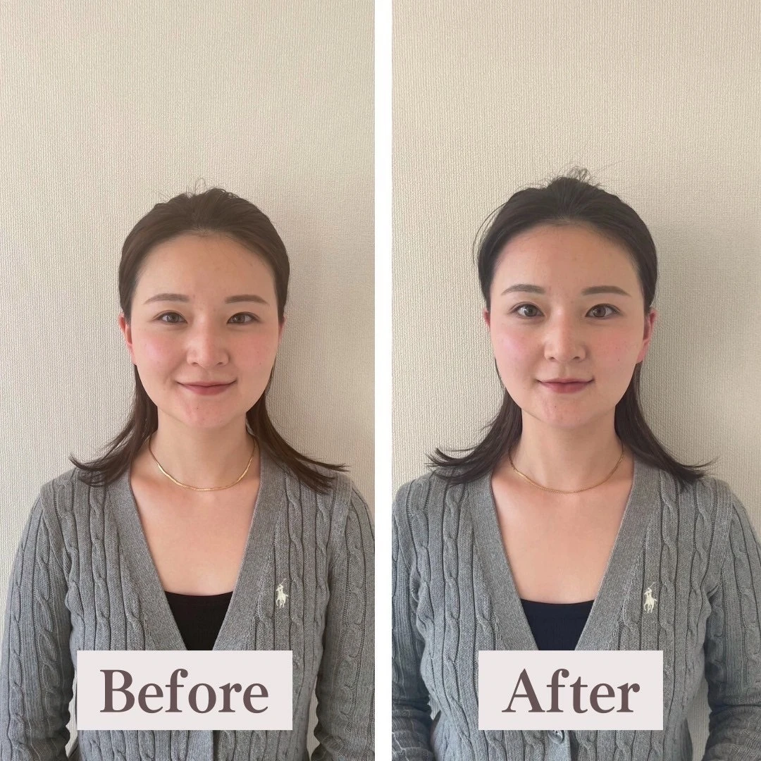 LINE_ALBUM_BeforeAfter_240201_50