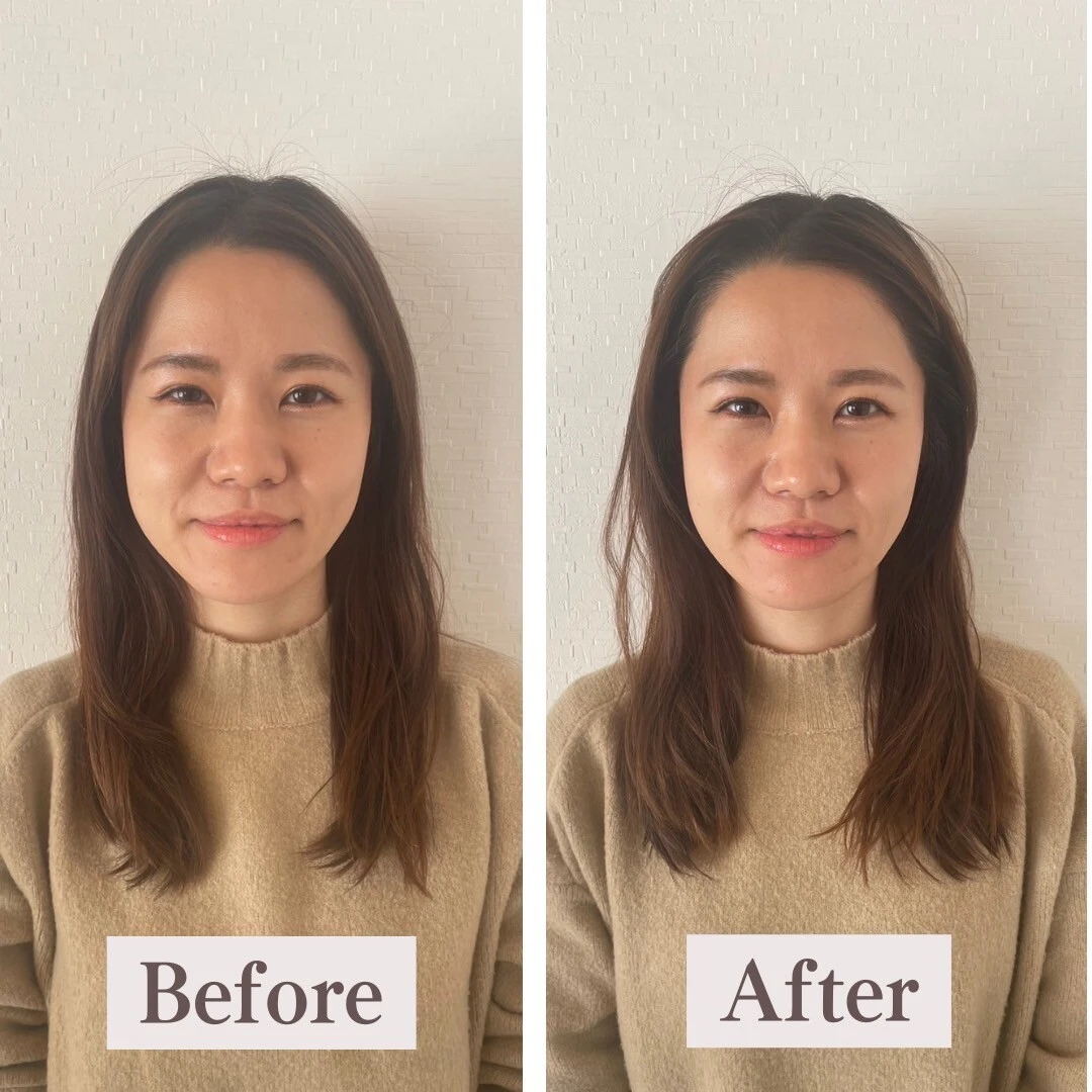 LINE_ALBUM_BeforeAfter_240201_46